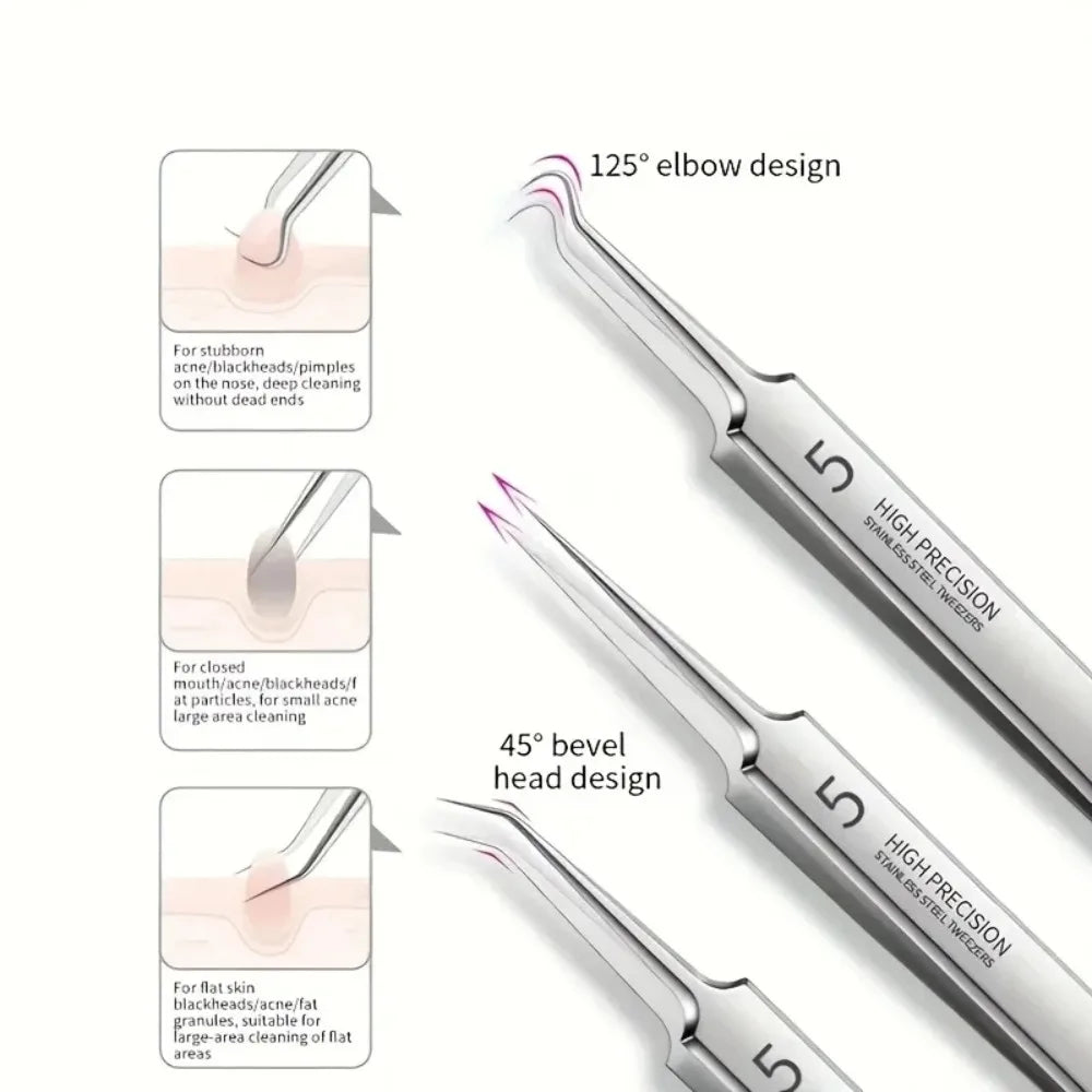 8-Piece Stainless Steel Blackhead & Blemish Extractor Kit