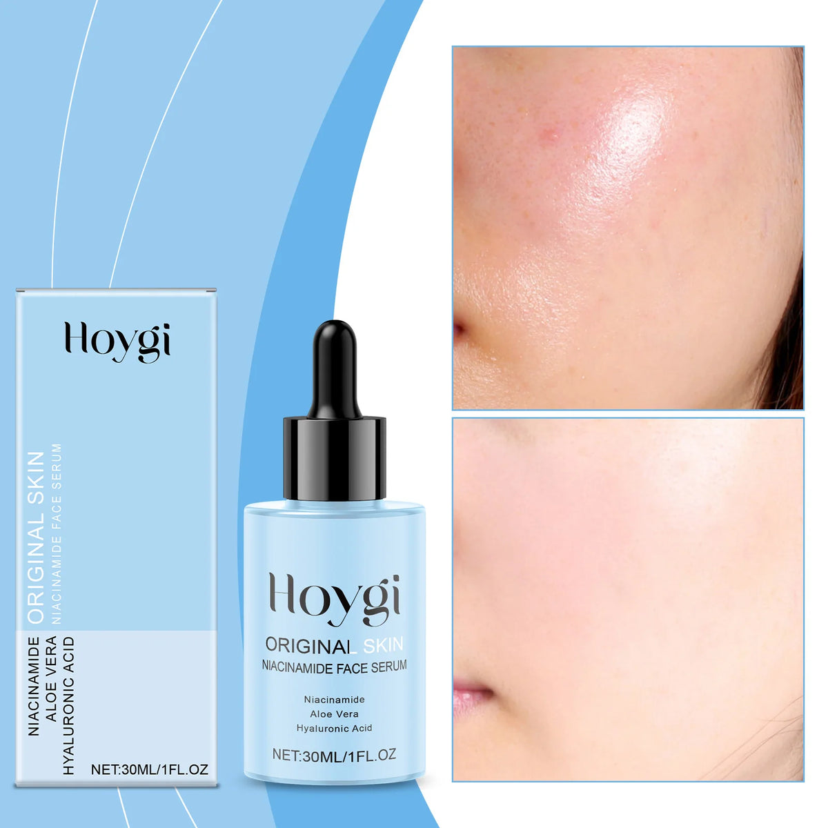 Niacinamide Face Serum – 30ml