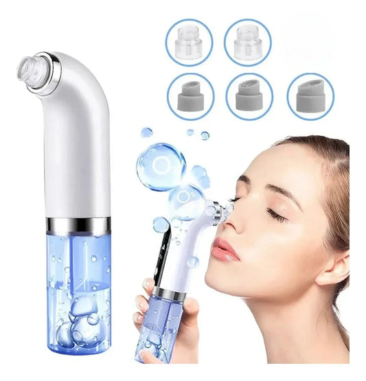Electric Blackhead Remover & Pore Vacuum