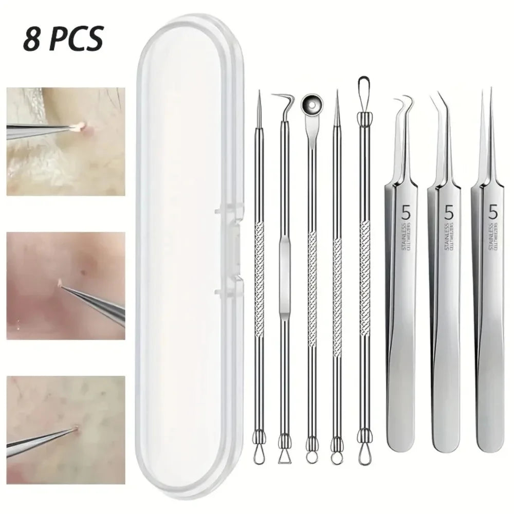 8-Piece Stainless Steel Blackhead & Blemish Extractor Kit